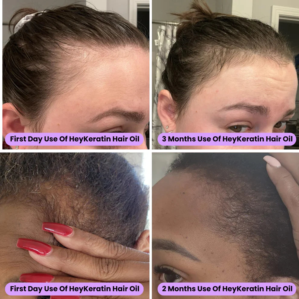 Batana Honduran Organic Growth Oil