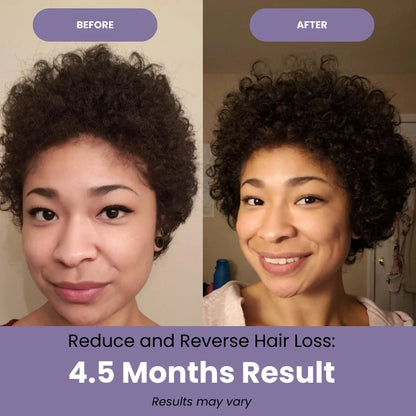 Batana Honduran Organic Growth Oil